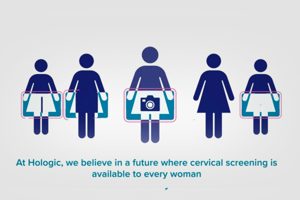 Cervical screening infographics
