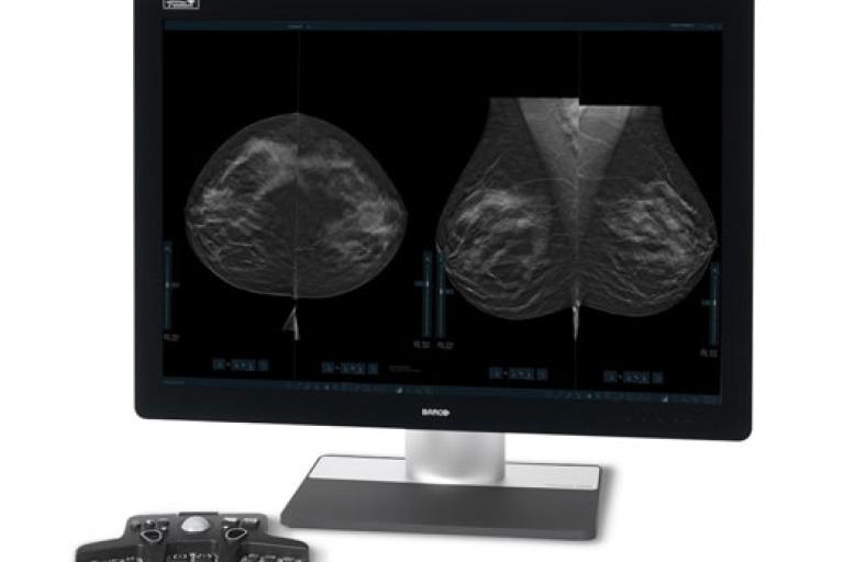 Monitor showing breast scans with controller on white background