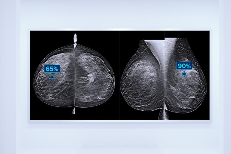 Breast scan images