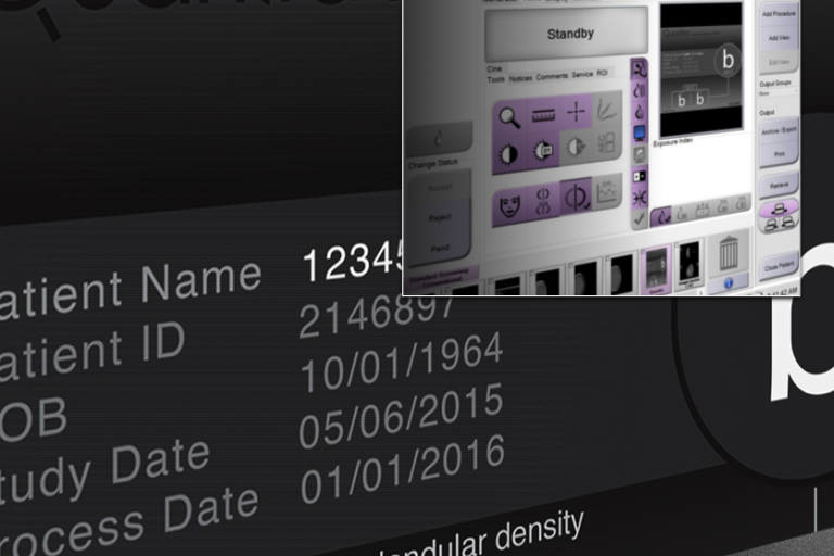 Close up image of monitor showing measurements and data