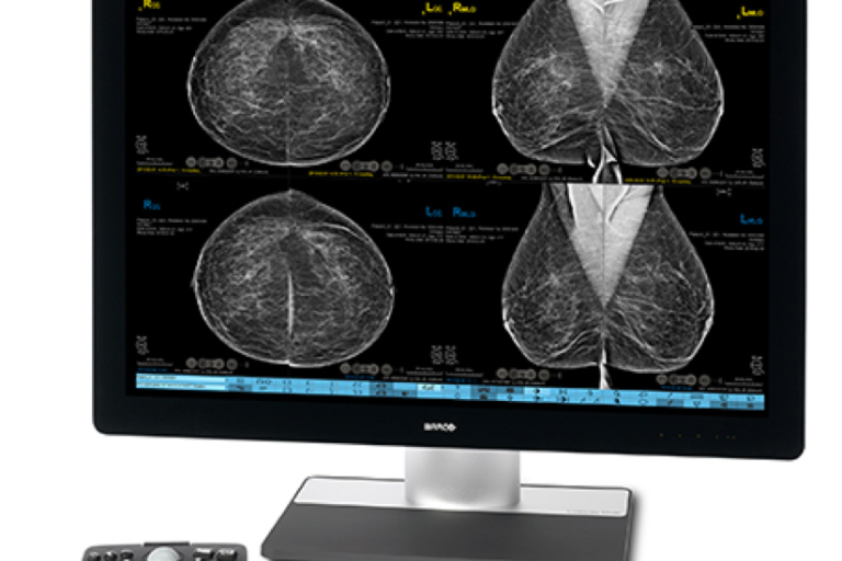 Monitor showing breast scan images with controller on white background