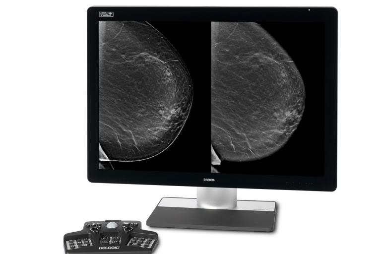 Monitor showing breast scans with controller