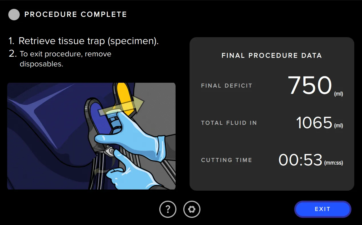 Screenshot from the Fluent Pro Fluid Management System user interface showing the procedure summary.