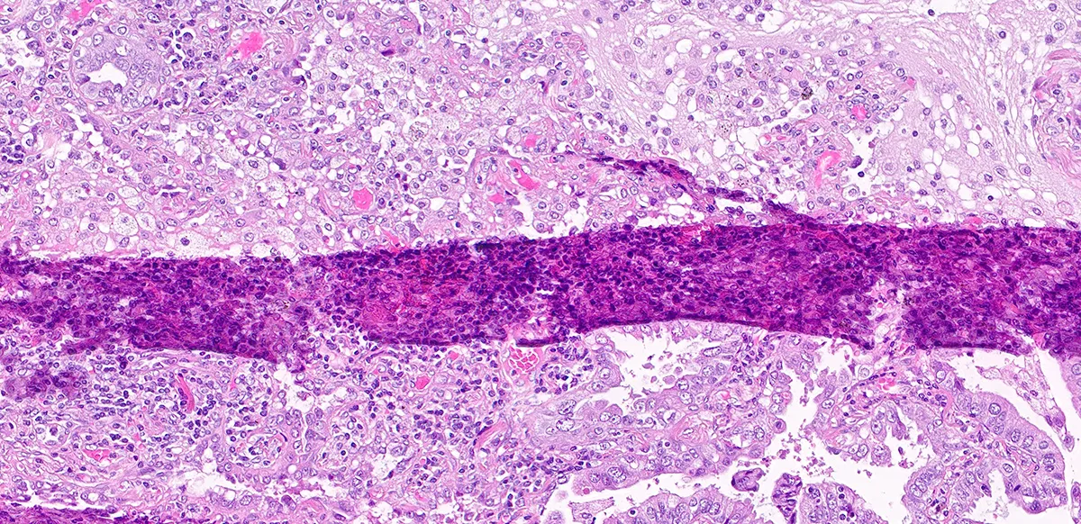 Image of folds and wrinkles