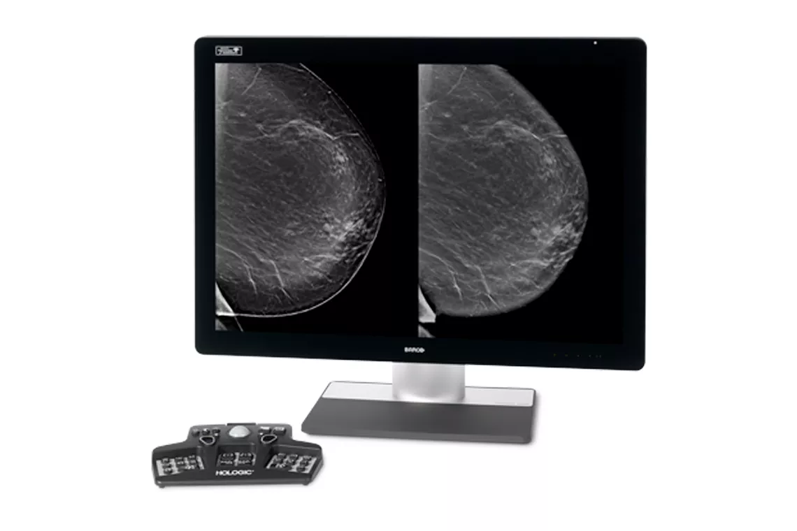 Breast scans on screen monitors in white background