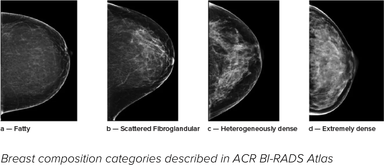 Breast imaging scans