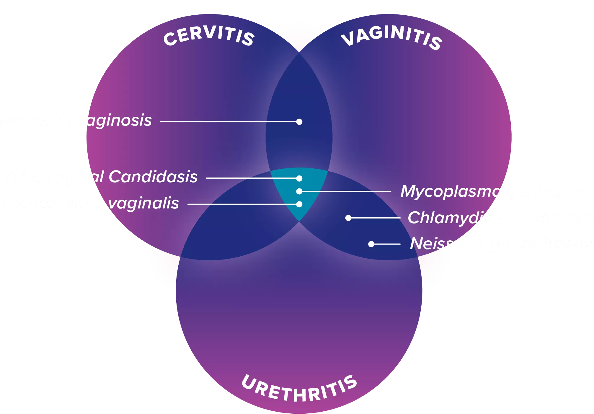 Overlapping illustration of Vaginitis Cervicitis Urethritis