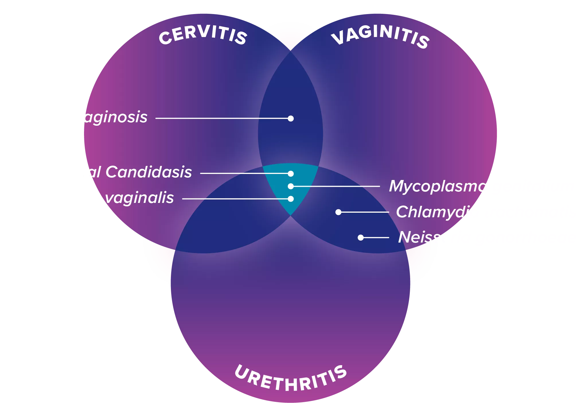 Overlapping illustration of Vaginitis Cervicitis Urethritis