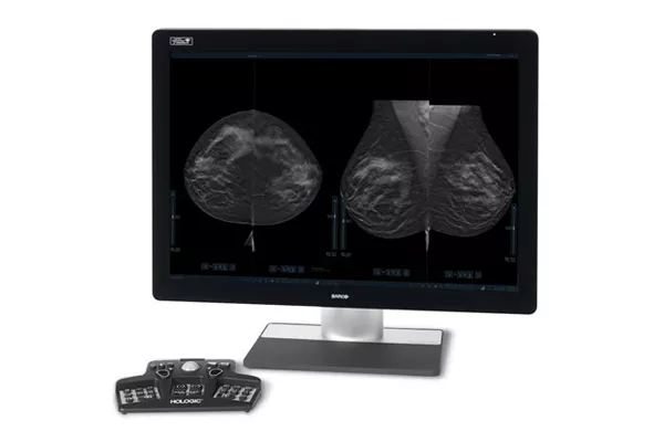Monitor showing breast scans with controller on white background