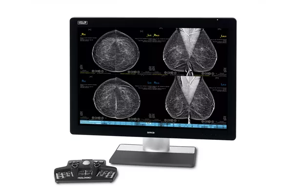 Monitor showing breast scan images with controller on white background