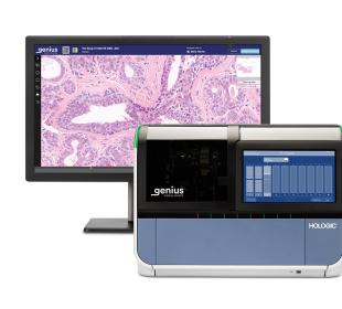 Genius Digital Diagnostics Imager and monitor showing cervical cells