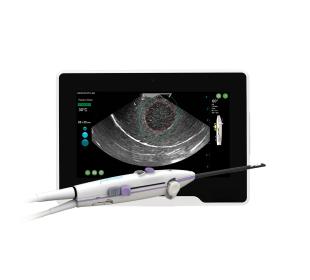 Sonata System showing the treatment device with SMART Tablet, designed for minimally invasive treatment of uterine fibroids.