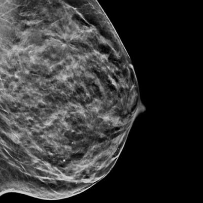 C-View™ Synthesised 2D Imaging på hvid baggrund