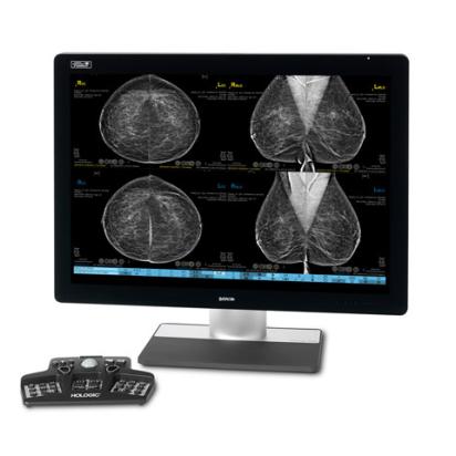 Hologic SecurView® Breast Imaging Workstation in white background